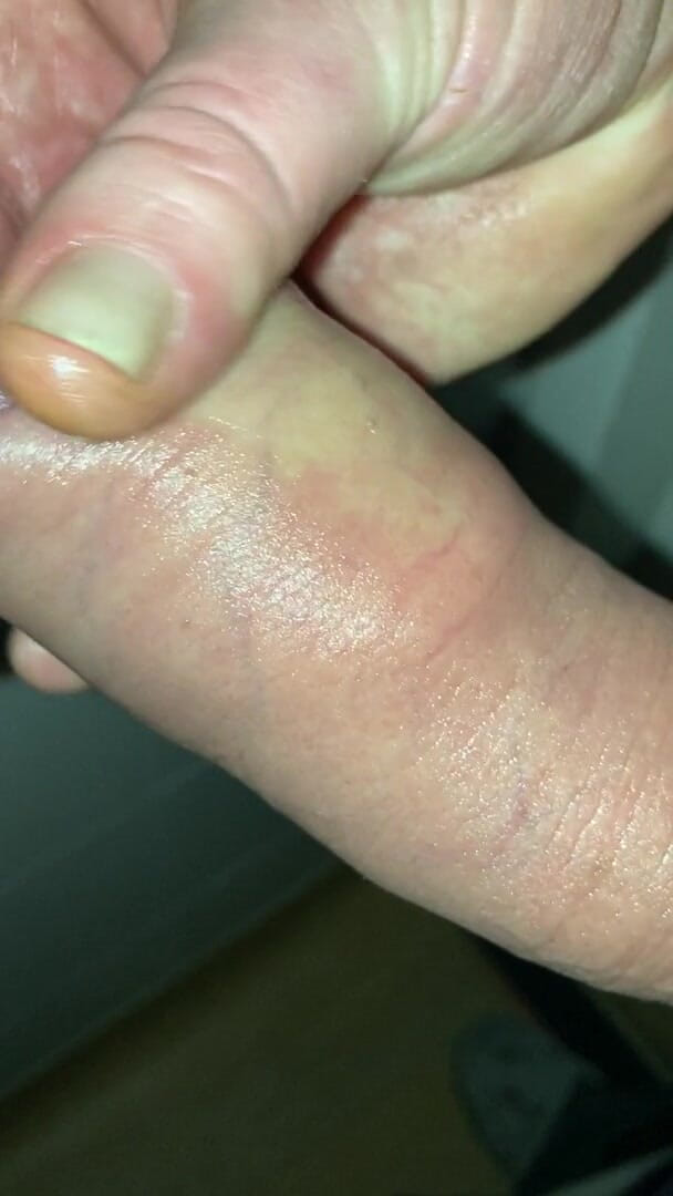 Foreskinguy: Con cặc bao quy đầu phình to dài, được bơm và bắn...