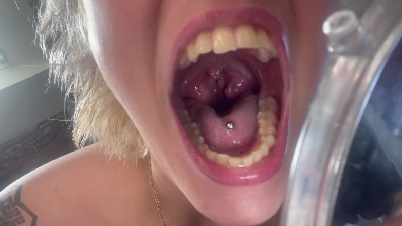 Glitterqueen1999: Mouth Tour Uvula Tonsils Teeth Tongue Vein Check