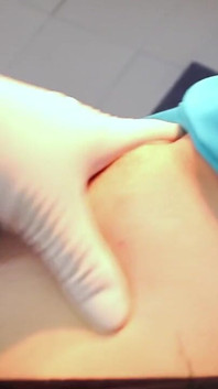 Gyno Exam 68