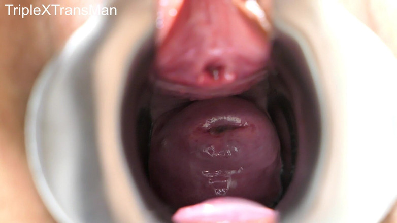 TripleXTransMan: 내 자궁 경부를 관통!