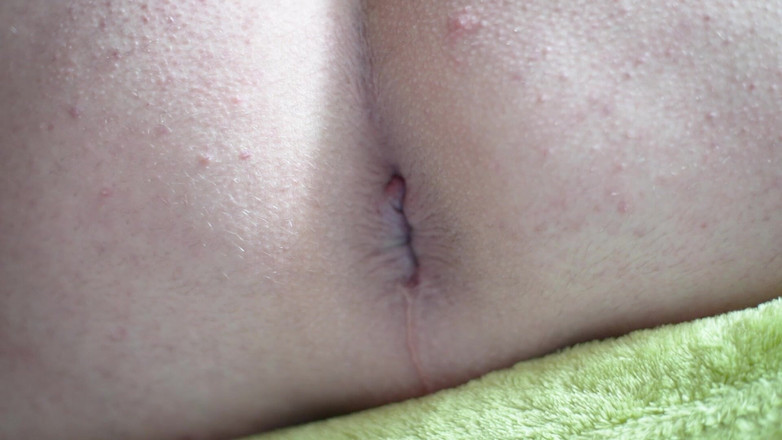 Marcus Pollack Gay: Jarak dekat bajingan