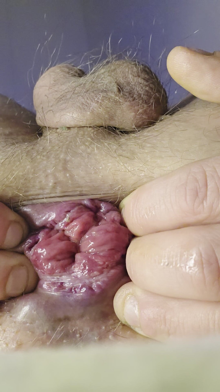 Nalekhome: 私の小さなバラと指で愛撫するお尻