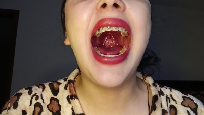 Golden domme: Chew Cheetos Bakış Açısı