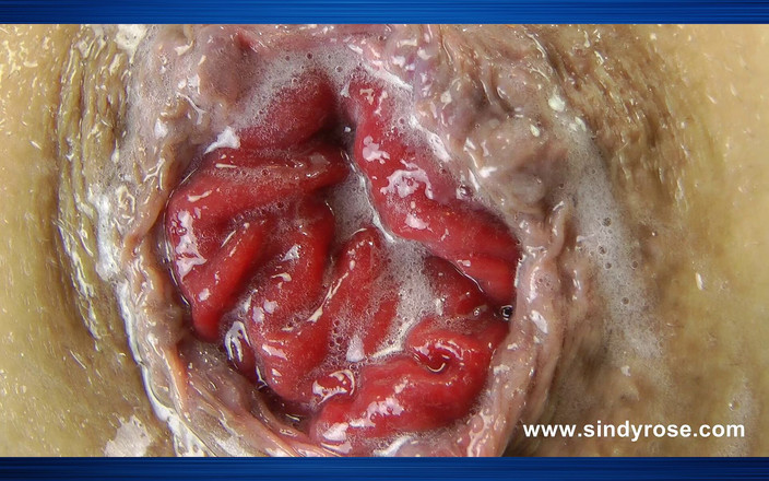 Sindyrose: Sindy rose checked dress studio fisting anale e prolasso