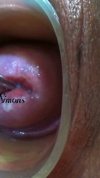 This Is What My Cervix Looks Like After a Year Without Seeing It.
