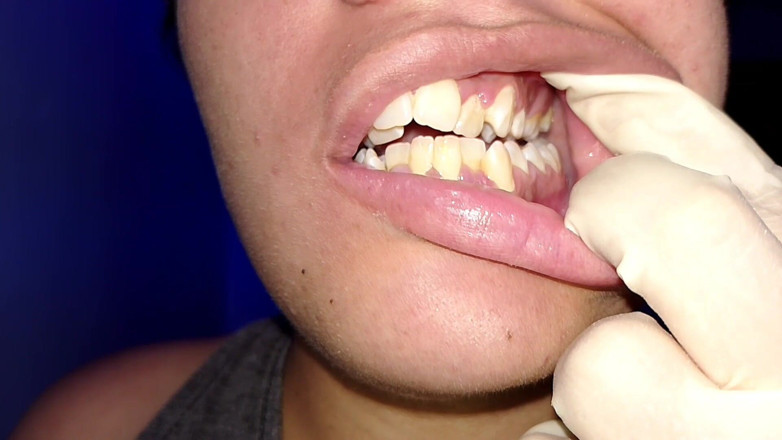 Elimoon: 치실 사용해 보기 (클로즈업)