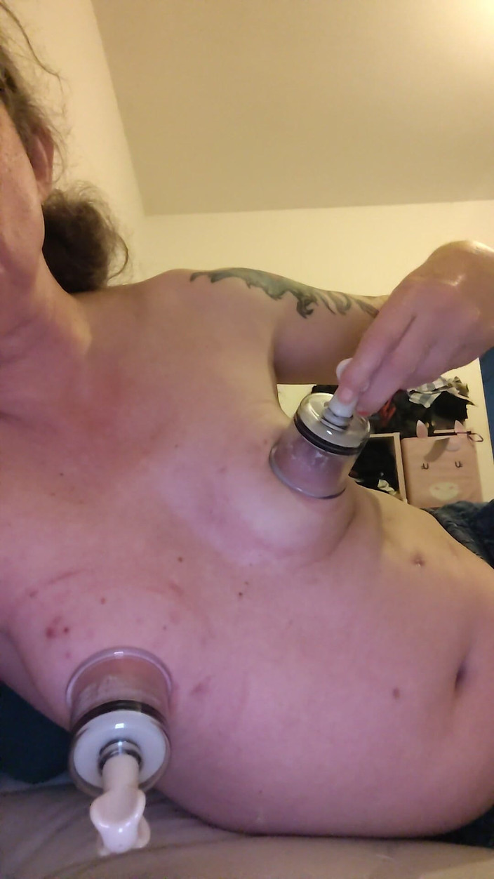 Alexia_mtf: その傷が私を刺激します