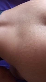 Anal Apertado