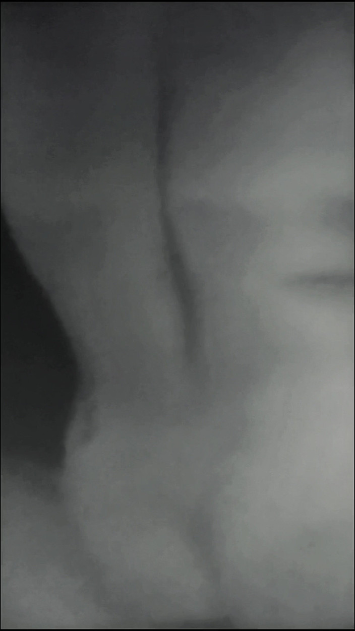 Lily & Theo: Rintihan yang paling sedap adalah kawan-kawan yang sudah berkahwin