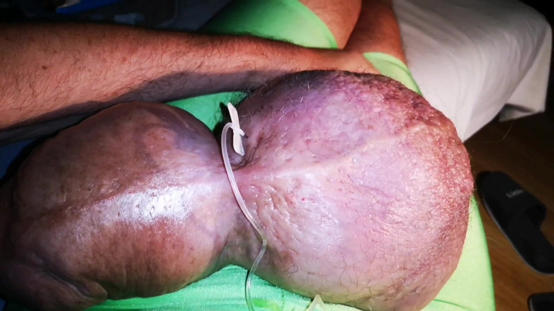 Monster_Meat_: 第三升葡萄糖