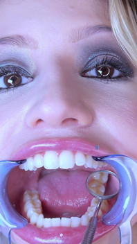 Teeth Fetish Extreme Close-up Dental Examination