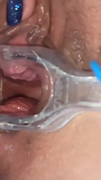 Masturbation with womb view and medical speculum, close up of my pussy