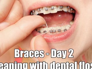 Arya Grander: Close up mouth tour, braces and dental floss