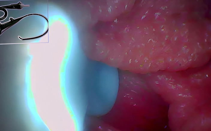 Ladybottox: Độc quyền: camera đi vào bên trong - chúng tôi tìm thấy điểm...