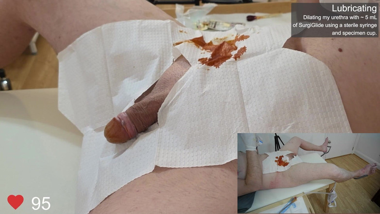 Clinical Climax: Catheter प्रविष्टि