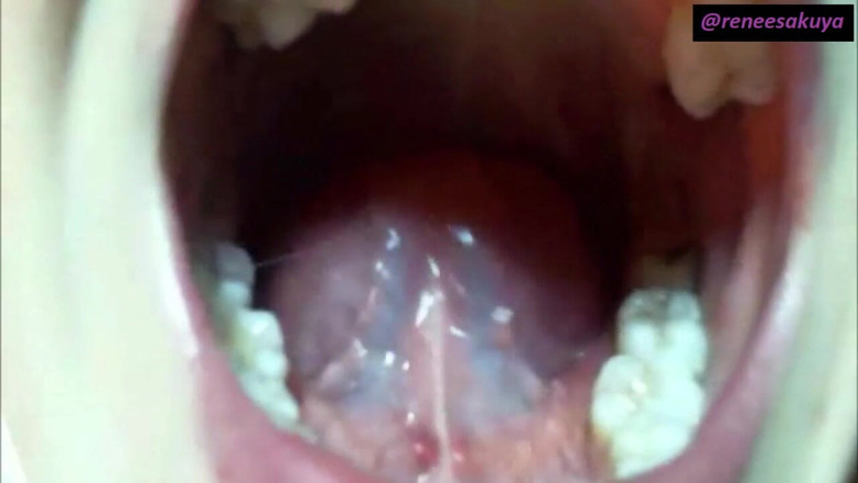 Renee Sakuya: Upclose Inside My Mouth