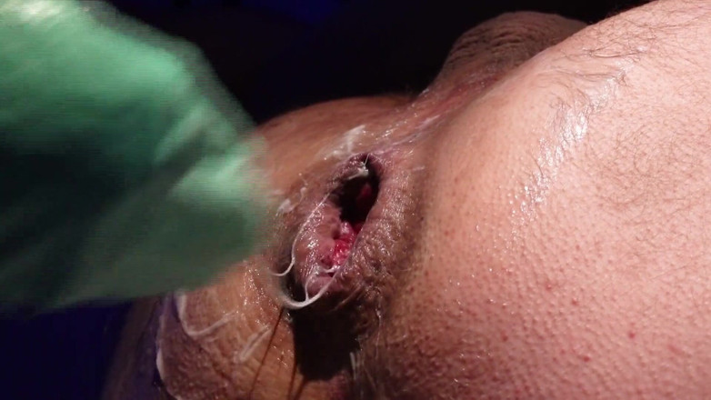 Marcus Pollack: Absolute Anal Treatment