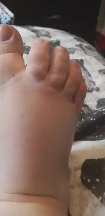 SSBBWLadyBrads: Fat chubby feet