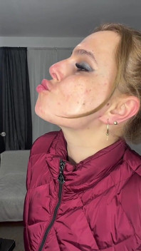 Puckered Lips