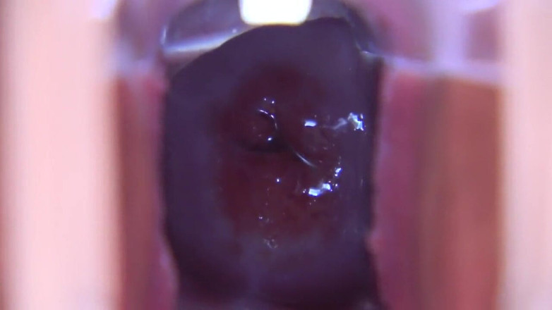 Asian happy ending: Asijský anděl 19115