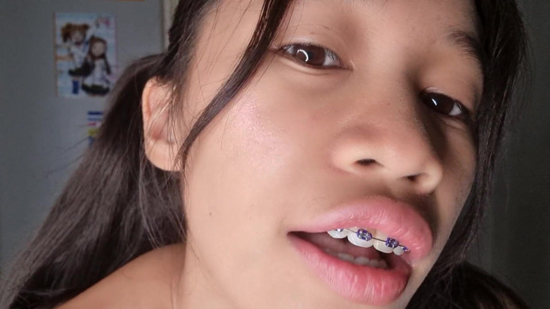 creamberryfairy: Sois cassée pour mon corps