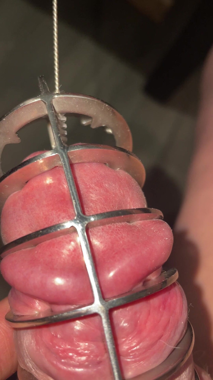 Slave guy: Berus botol di Urethra