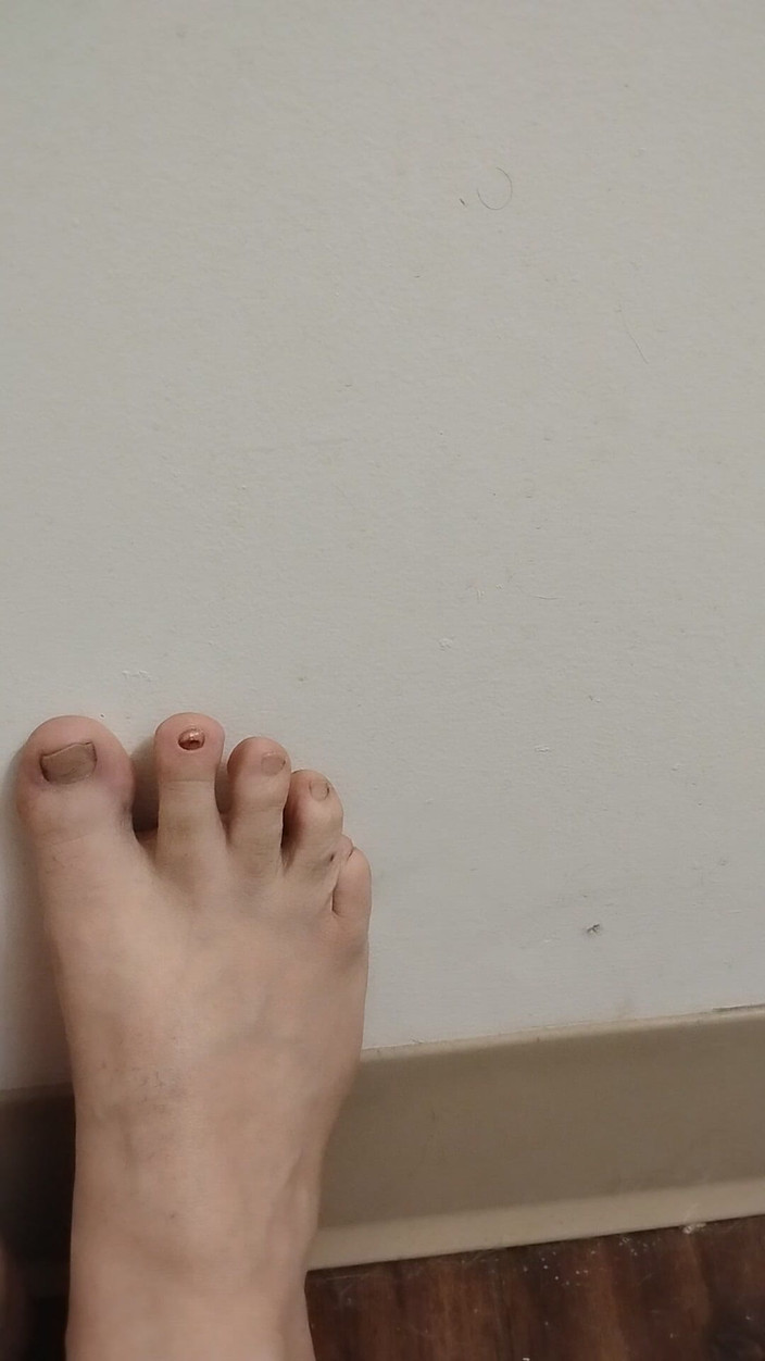 JG Risk: 11-26-2025 dedos fofos