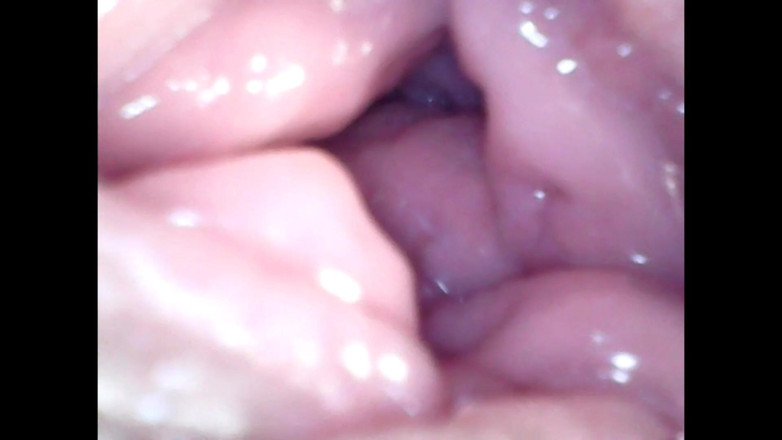 LizAngel: Endoskopische wieder in meiner vagina