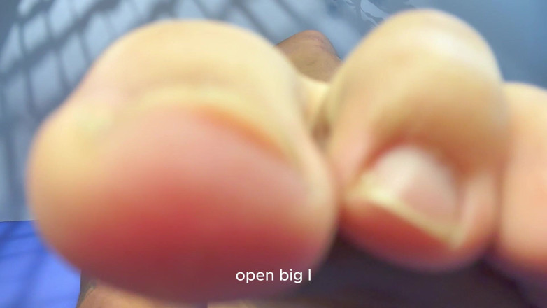 Rollerpublic: Stinky Dirty Foot Part 1