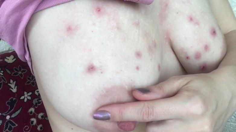 Risky Hairy Couple: How My Tits Look After BDSM Play