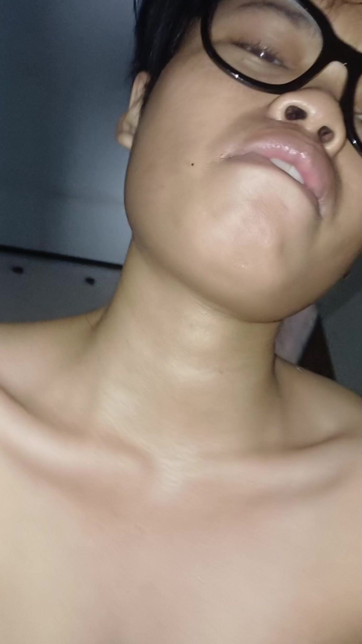 Theresia Nirvana: En 18-årig tjej har svårt att bli gravid