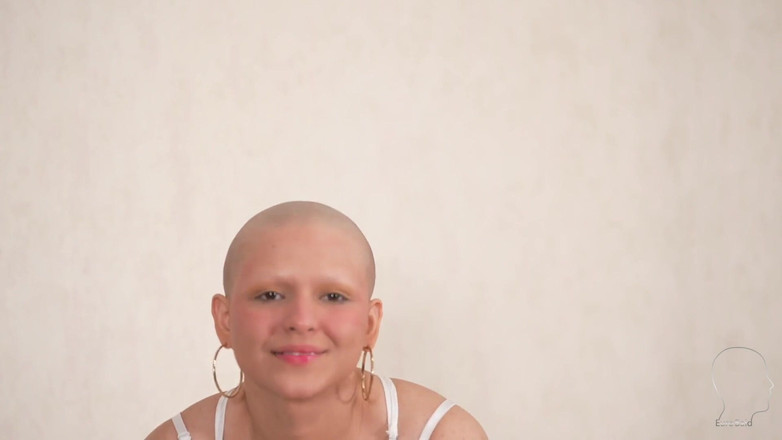 Euro Bald: 스 칼 렛