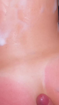 My Stepsister Got Sunburned and Asked for Help!
