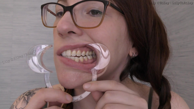 Lily O'Riley: Fetiș cu gură băloasă W / cheek Spreader