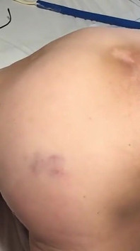 Rimozione di un grosso plug dal culo da una moglie di 60 anni gilf nonna matura anale