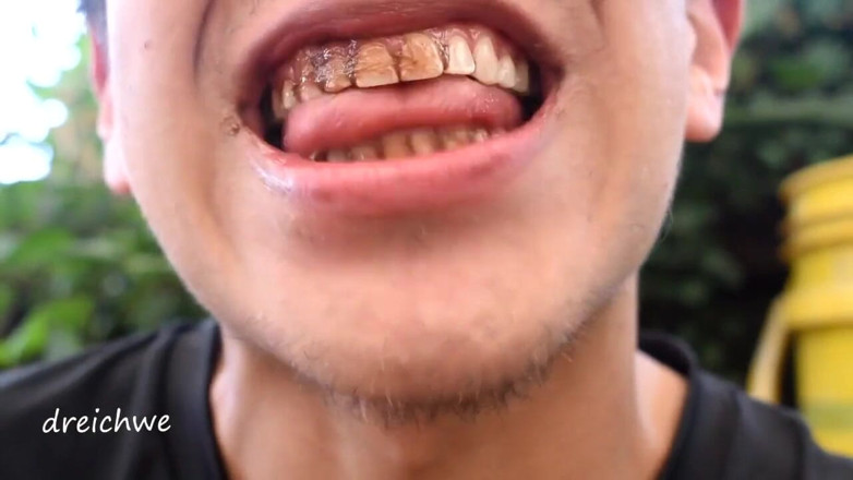 Dreichwe: Chocolate on the teeth