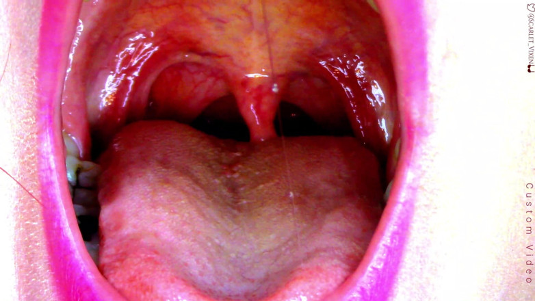 Scarlet Vixen: Sexy scarlet sagt Ahhhh - uvula zeigt