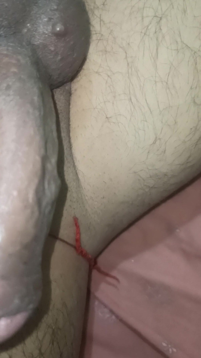 Deepak1989cage: Núm vú nóng bỏng của Bhabhi bị bú bằng miệng