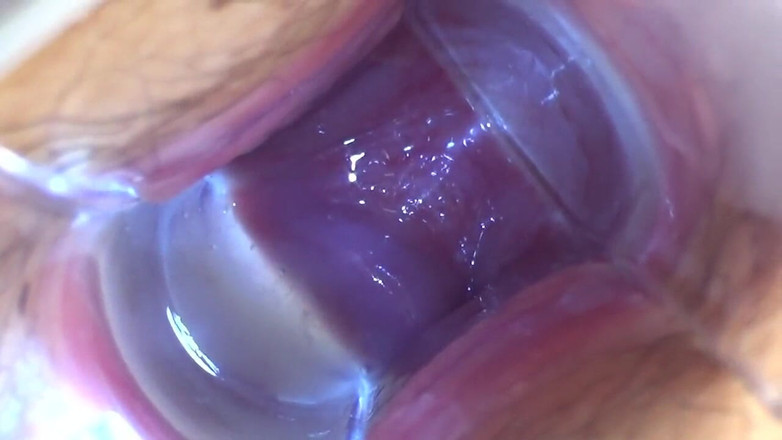 Temptation: Înger asiatic 18787