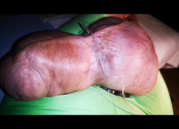 Monster_Meat_: Des grosses couilles rebondissent de gauche à droite