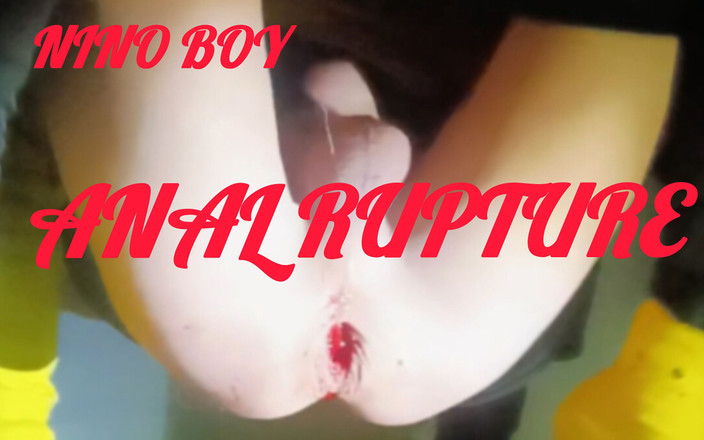 Culopeke: Skoro se mu podařilo dostat ruku do jejího sladkého zadku