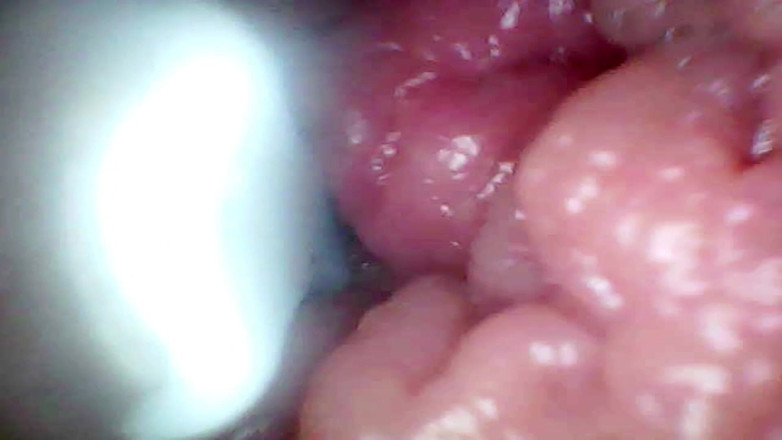 Ladybottox: Une Caméra Endoscopique Enregistre Le Point G De Ma Femme....