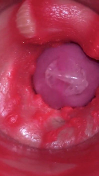 Camera Inside Pussy - Powerfull Cum in Pussy! Best Internal Asmr