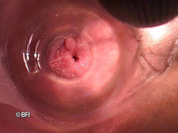 Pegging insertion: Дивні файли 162