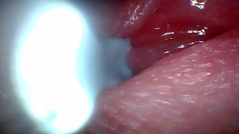 Ladybottox: Endoscope Camera Captures Moment of Male Ejaculation 4K