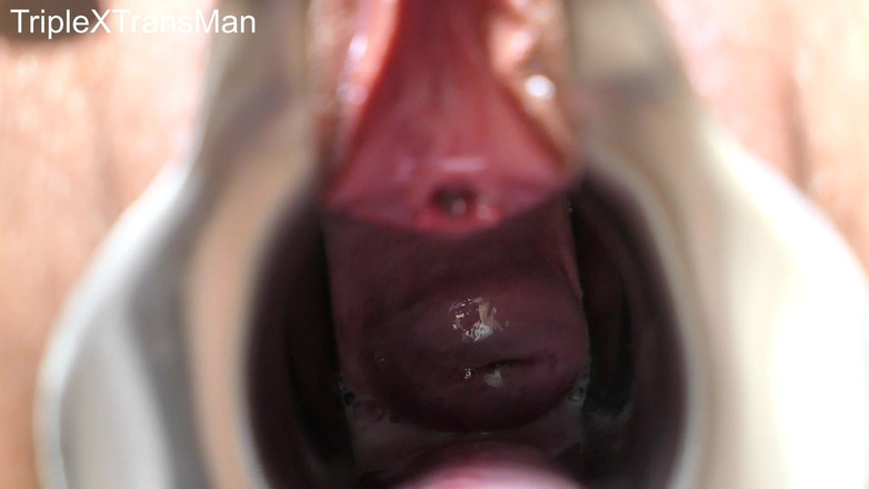 TripleXTransMan: मेरी गर्भाशय ग्रीवा में घुसना!