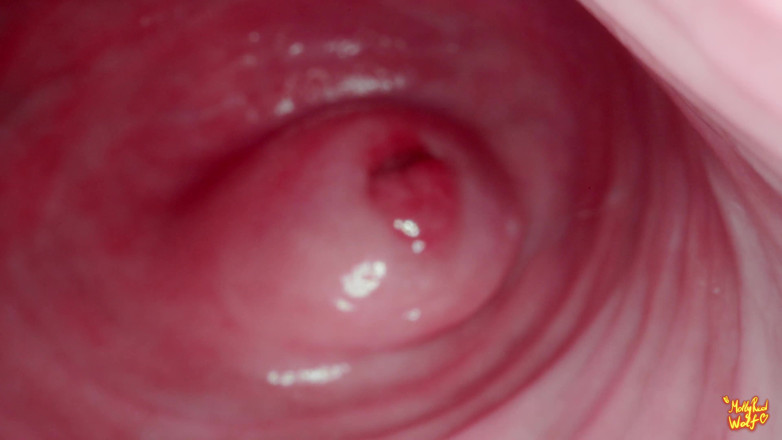 MollyRedWolf: Hey Stepbrother! Let's Play Gynecologist? Gyno, Endoscopy - Mollyredwolf