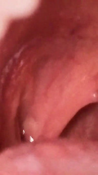 Mulut fetish uvula tutup Saya tercekik pada BBC yang keras