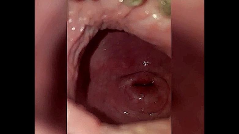 RomanticThuG: Setelah a