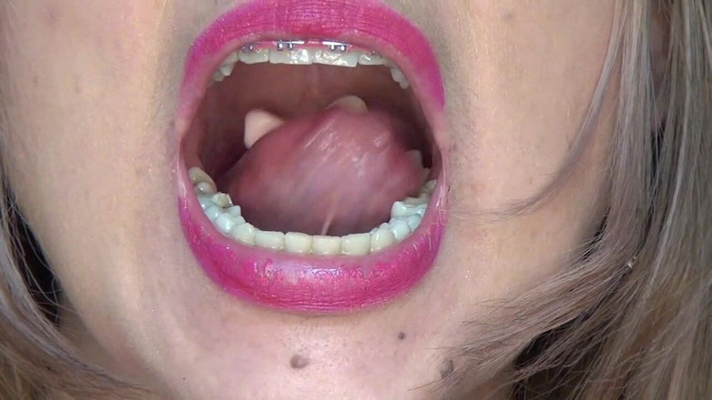 Angel eyes studio: एक ही समय में बहुत सारे गम्मी भालू निगलना !!